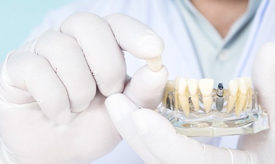 White-gloved hands holding sample dental implant and crown