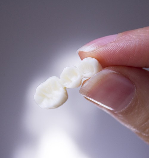 Dentist holding a bridge