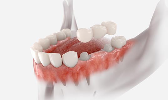 Digital illustration of traditional bridge