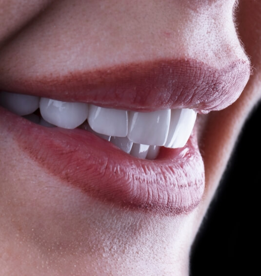 Closeup of flawless smile after gum recontouring