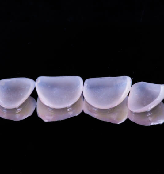 Metal free dental crowns prior to placement