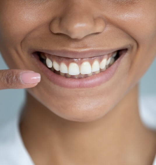 Person pointing to flawless smile after Invisalign clear braces