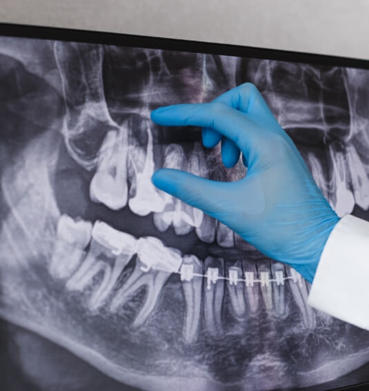 Dentist examining all digital x-rays