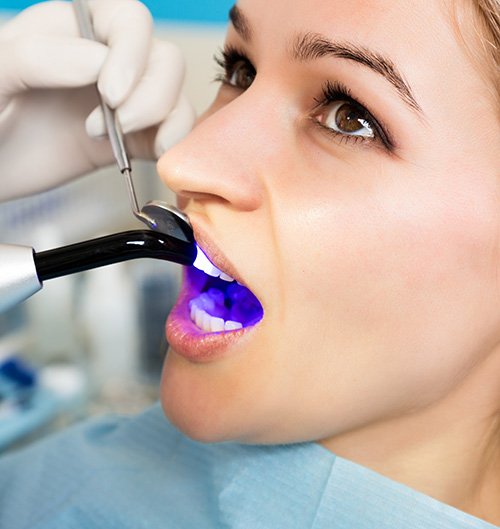 A man undergoing a tooth-colored fillings treatment