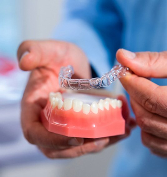 Invisalign aligners being slipped onto a model of teeth