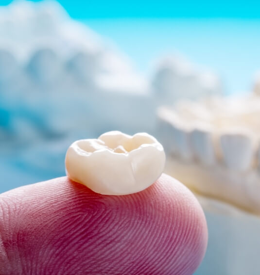 Dental crown resting on fingertip prior to placement