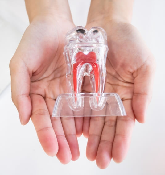 Model of the inside of a tooth used to explain root canal treatment