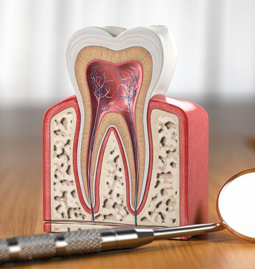 a model of a tooth presenting the root canal