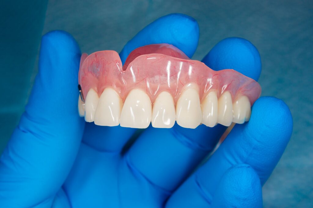 Blue-gloved hand holding upper arch of dentures